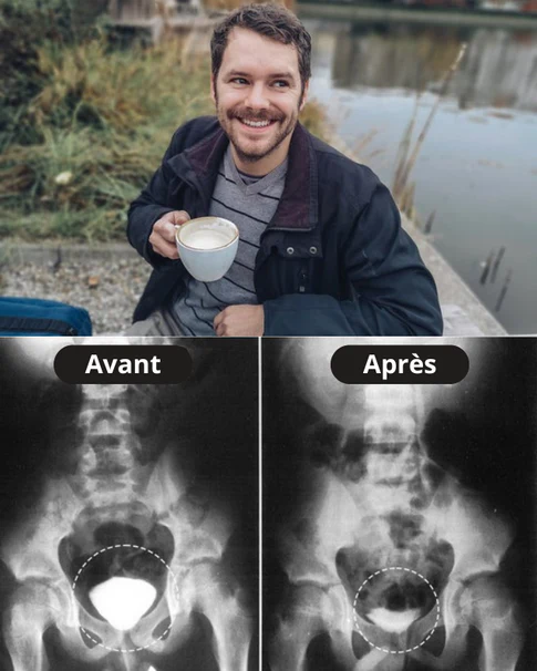 Témoignage homme confiance retrouvée avant après