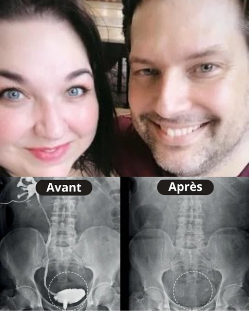 Couple heureux confiance intime restaurée
